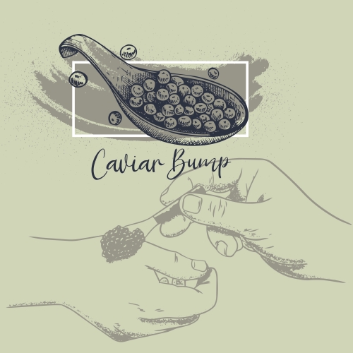 Caviar Bump